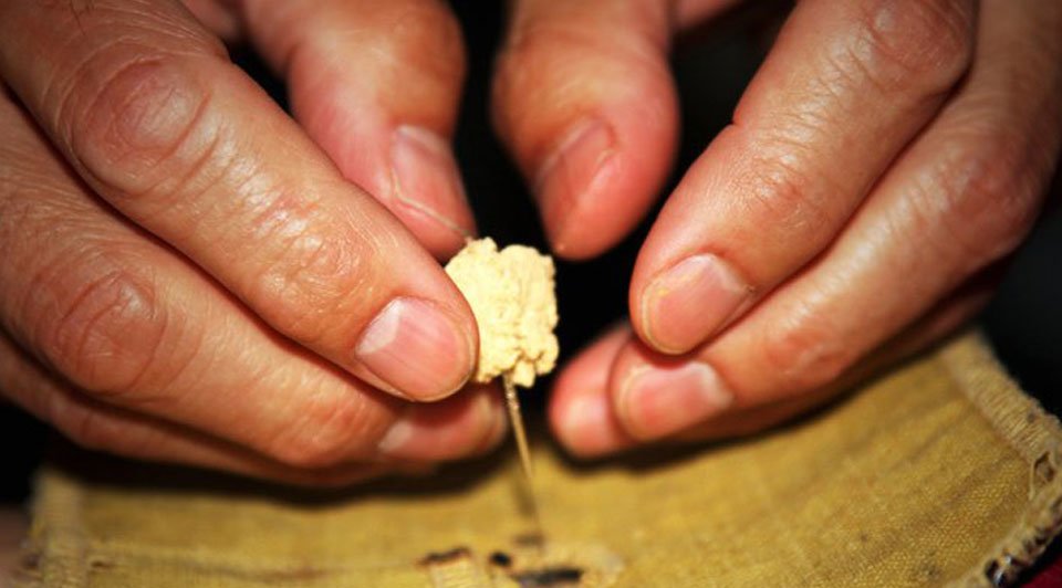 Japanese Acupuncture Phoenix Feel Better Today!